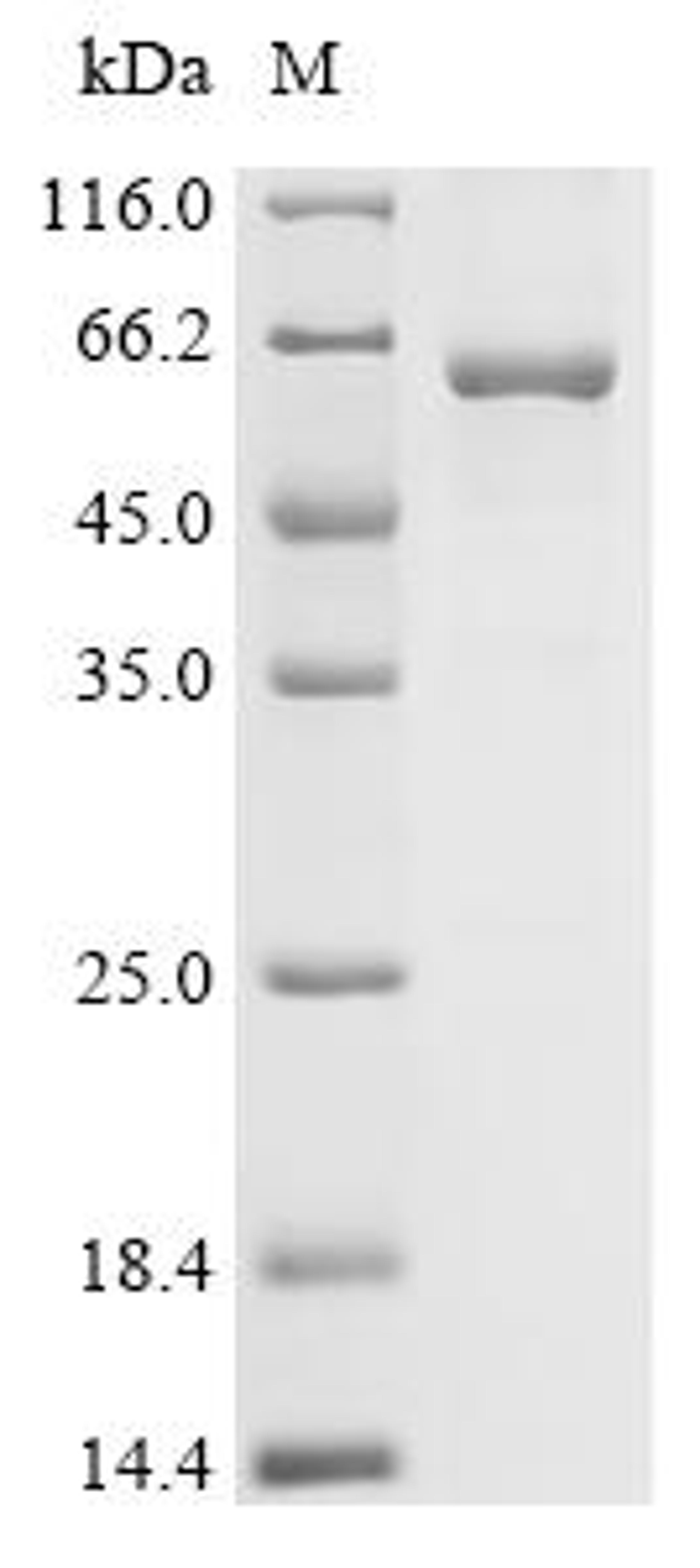 (Tris-Glycine gel) Discontinuous SDS-PAGE (reduced) with 5% enrichment gel and 15% separation gel.