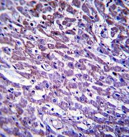 Immunohistochemical staining of paraffin embedded human heart tissue using XIRP1 antibody (primary antibody dilution at: 1:10-50)