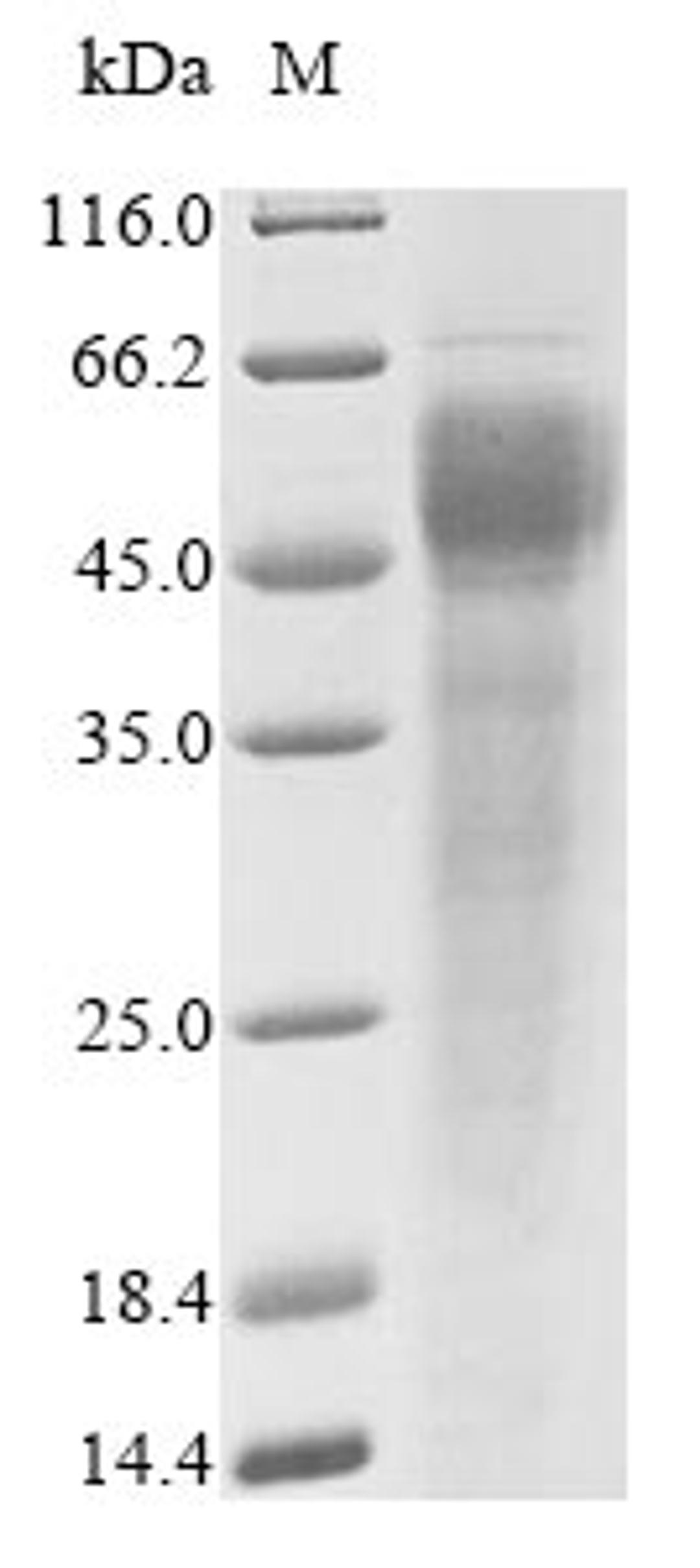 (Tris-Glycine gel) Discontinuous SDS-PAGE (reduced) with 5% enrichment gel and 15% separation gel.