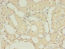 Immunohistochemistry of paraffin-embedded human kidney tissue using CSB-PA881018EA01HU at dilution of 1:100