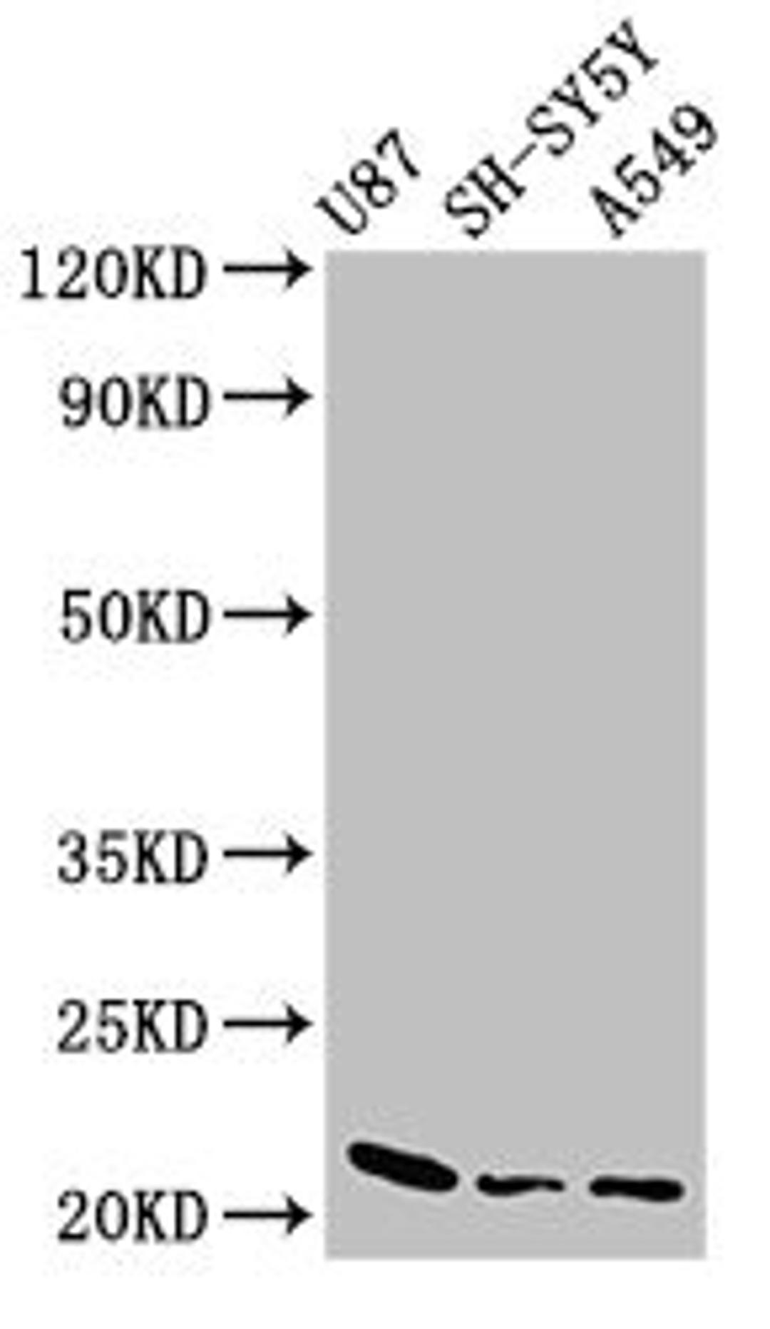 Western Blot. Positive WB detected in: U87 whole cell lysate, SH-SY5Y whole cell lysate, A549 whole cell lysate. All lanes: NDUFS4 antibody at 2.5µg/ml. Secondary. Goat polyclonal to rabbit IgG at 1/50000 dilution. Predicted band size: 21 kDa. Observed band size: 21 kDa