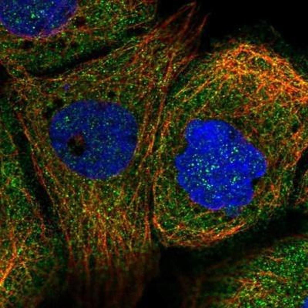 Immunocytochemistry/Immunofluorescence: TUSC4 Antibody [NBP1-82537] - Staining of human cell line A-431 shows positivity in cytoplasm.