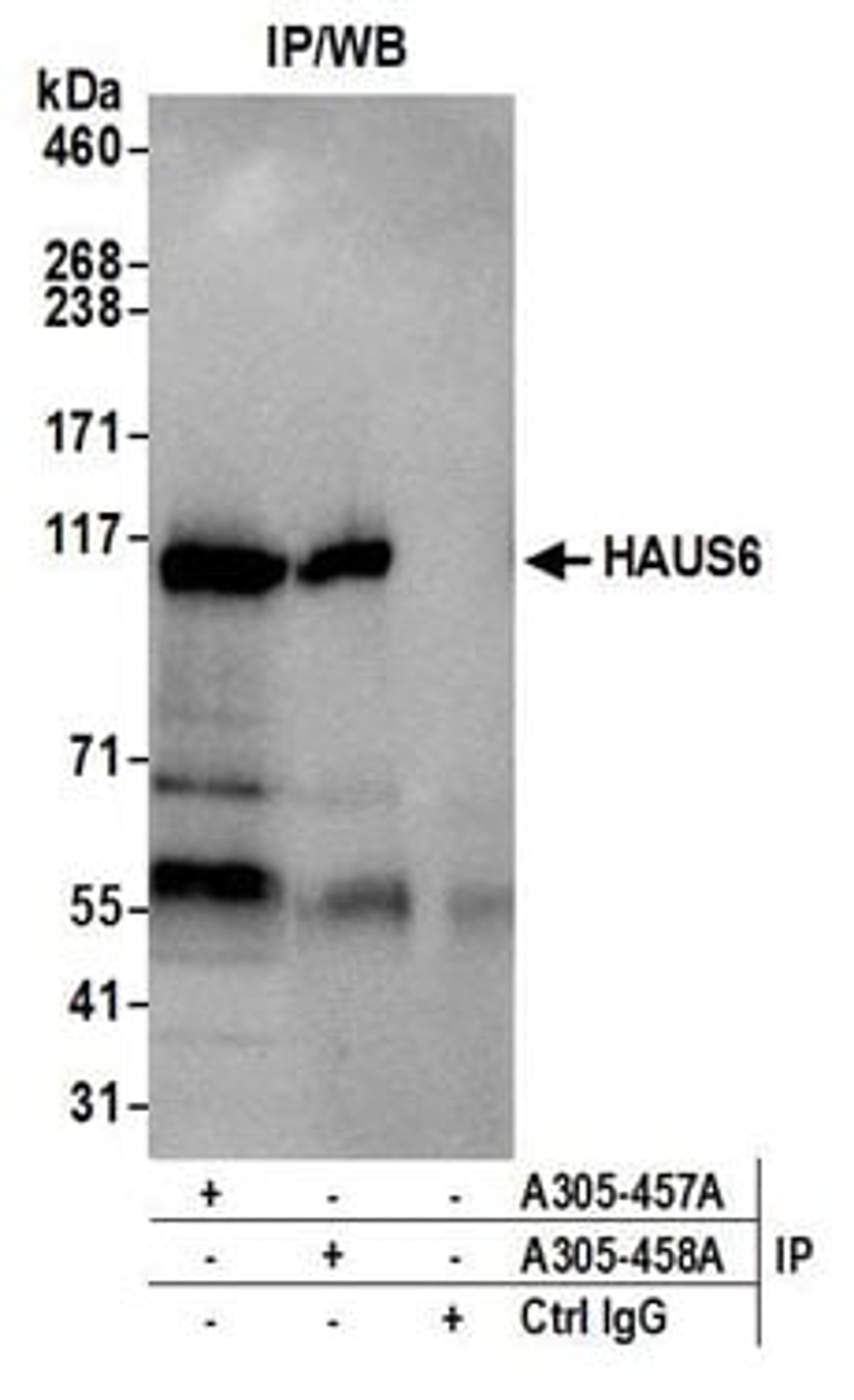 Detection of human HAUS6 by western blot of immunoprecipitates.