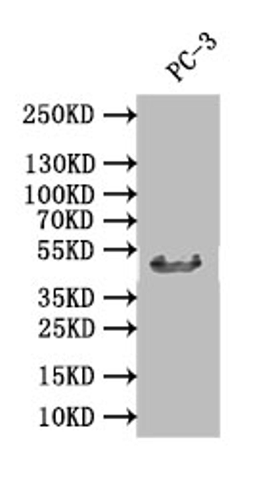 Western Blot. Positive WB detected in: PC-3 whole cell lysate. All lanes: DDB2 antibody at 1:1000. Secondary. Goat polyclonal to rabbit IgG at 1/50000 dilution. Predicted band size: 47 kDa. Observed band size: 47 kDa.