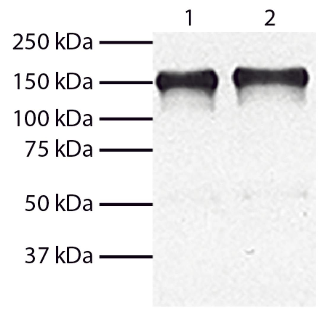 Total cell lysates from HEp-2 (Lane 1) and MIA PaCa-2 (Lane 2) cells were resolved by electrophoresis, transferred to PVDF membrane, and probed with Mouse Anti-Human EGFR-UNLB (Cat. No. 99-728). Proteins were visualized using Goat Anti-Mouse IgG, Human ad