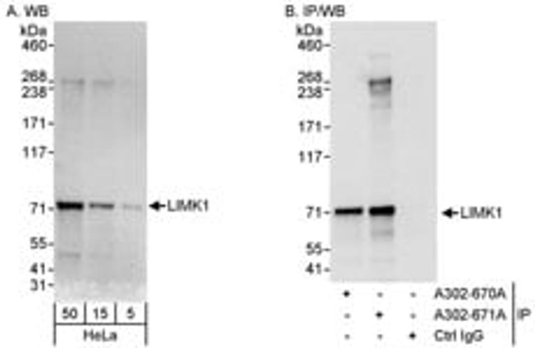 Detection of human LIMK1 by western blot and immunoprecipitation.