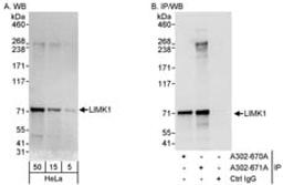 Detection of human LIMK1 by western blot and immunoprecipitation.