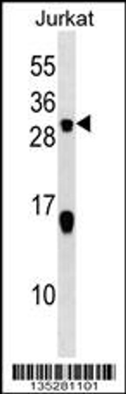 Western blot analysis in Jurkat cell line lysates (35ug/lane).