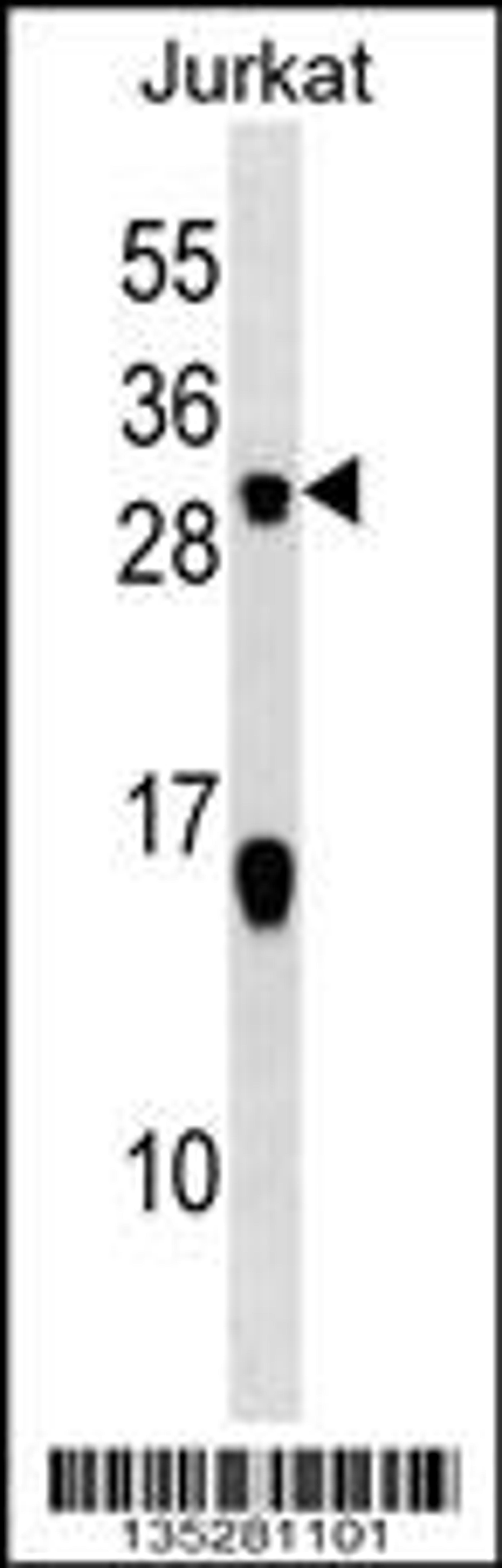 Western blot analysis in Jurkat cell line lysates (35ug/lane).