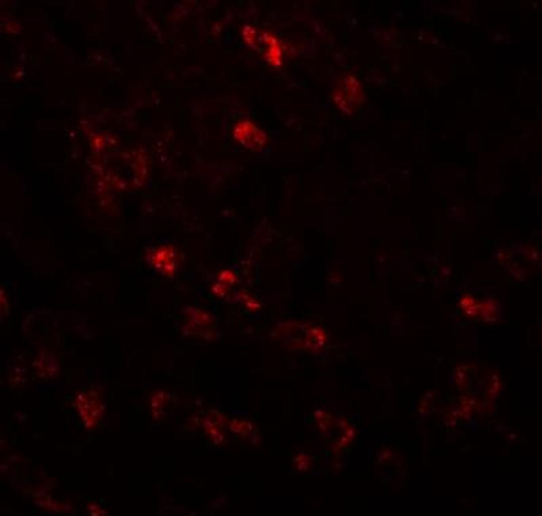 Immunocytochemistry/Immunofluorescence: CDC16 Antibody [NBP1-77155] - Immunofluorescence of APC6 in human liver tissue with APC6 antibody at 20 ug/mL.