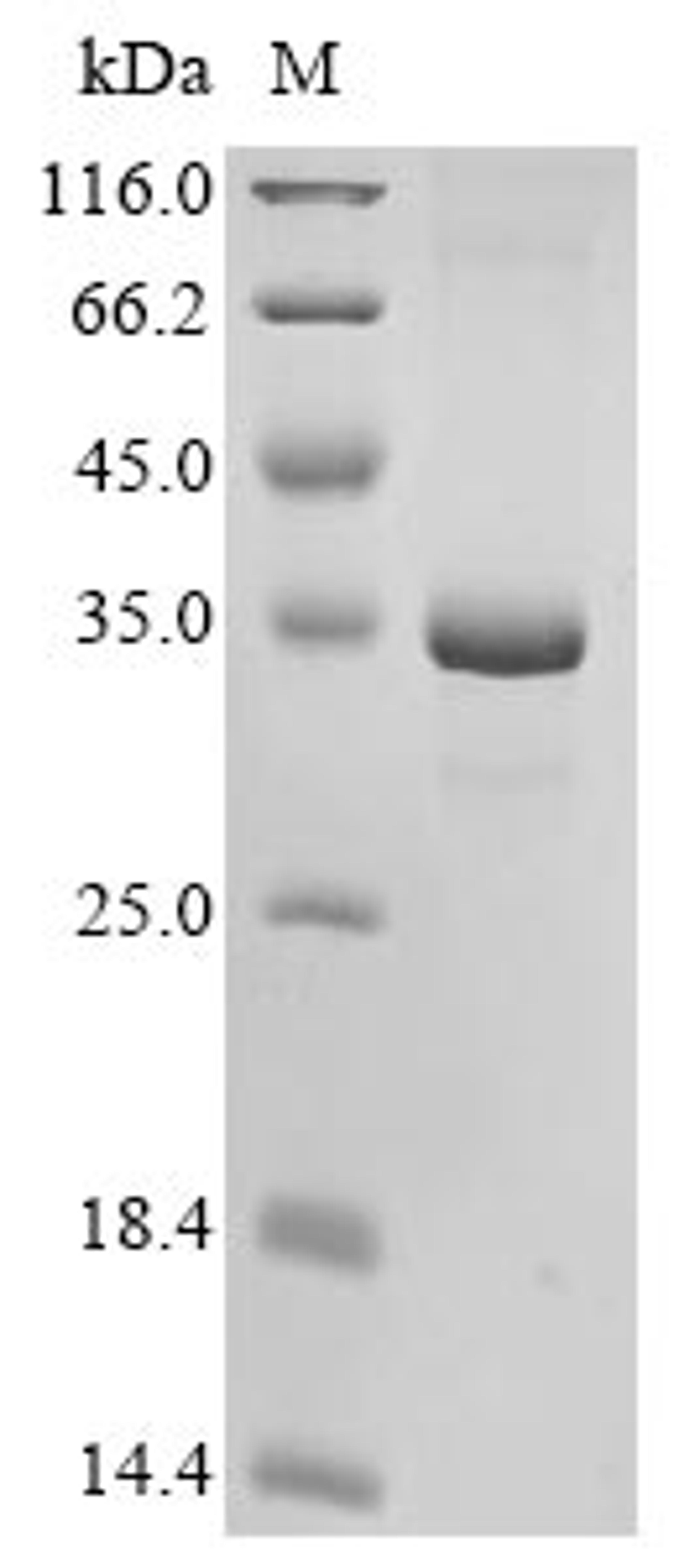 (Tris-Glycine gel) Discontinuous SDS-PAGE (reduced) with 5% enrichment gel and 15% separation gel.