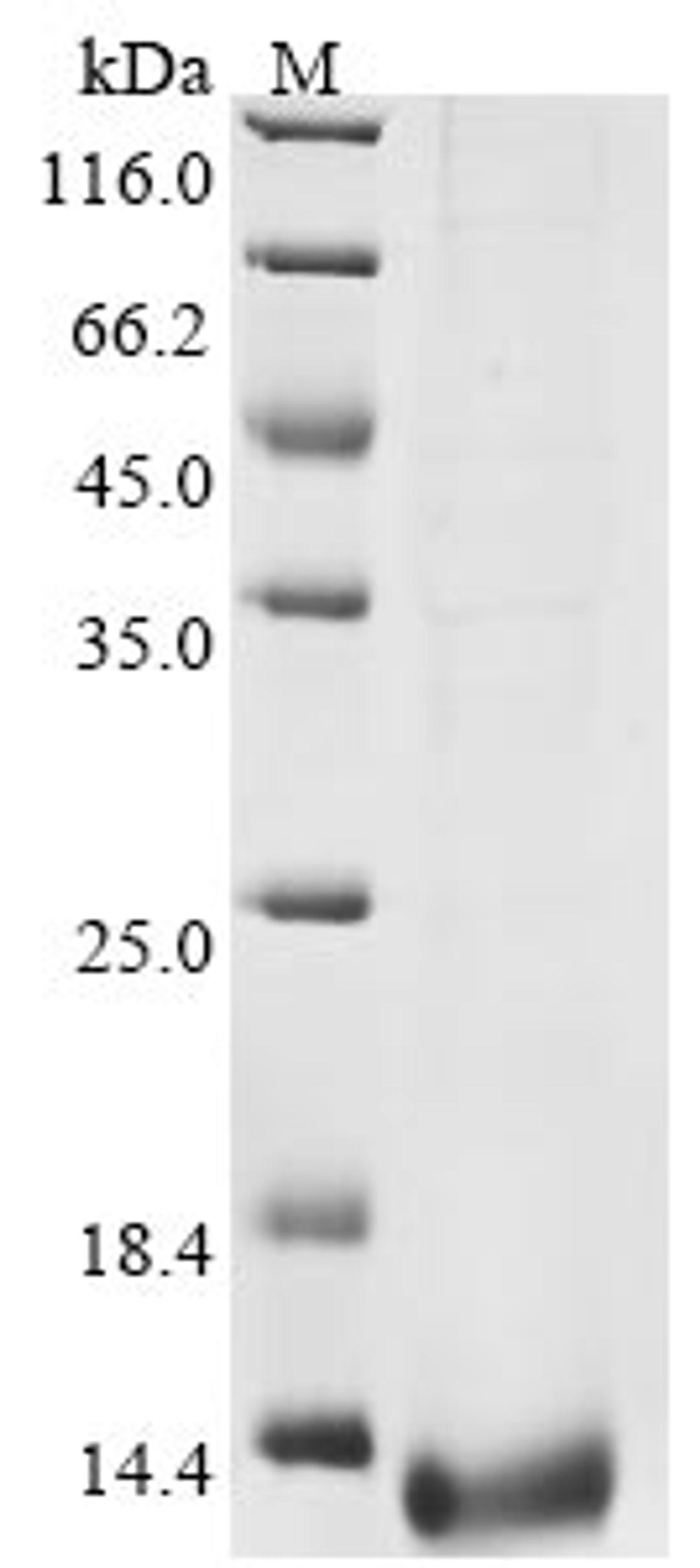 (Tris-Glycine gel) Discontinuous SDS-PAGE (reduced) with 5% enrichment gel and 15% separation gel.