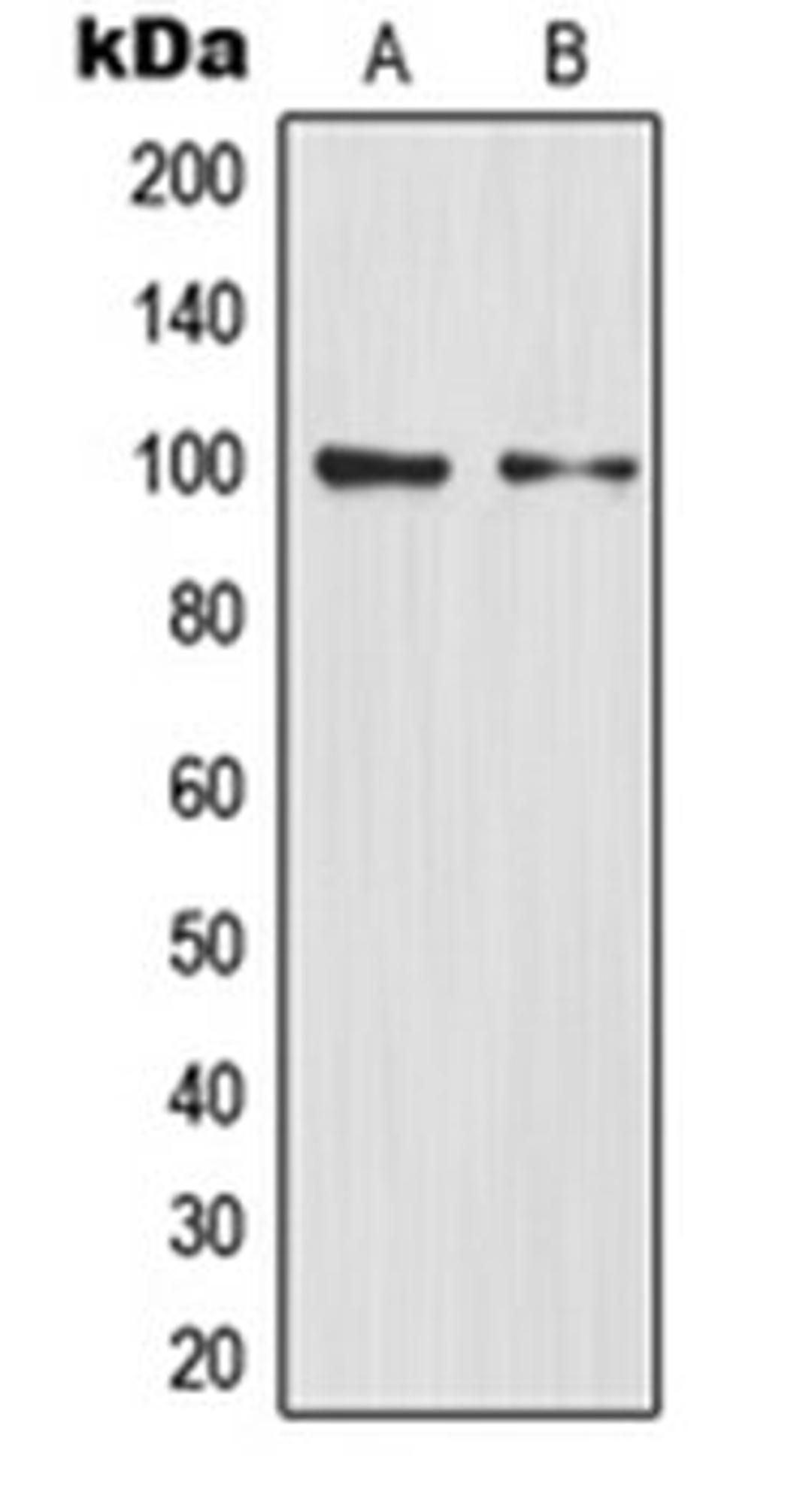 Western blot analysis of HEK293T (Lane 1), mouse liver (Lane 2) whole cell lysates using NFKB2 antibody