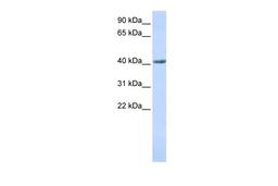 Antibody used in WB on Human Stomach at 0.2-1 ug/ml.