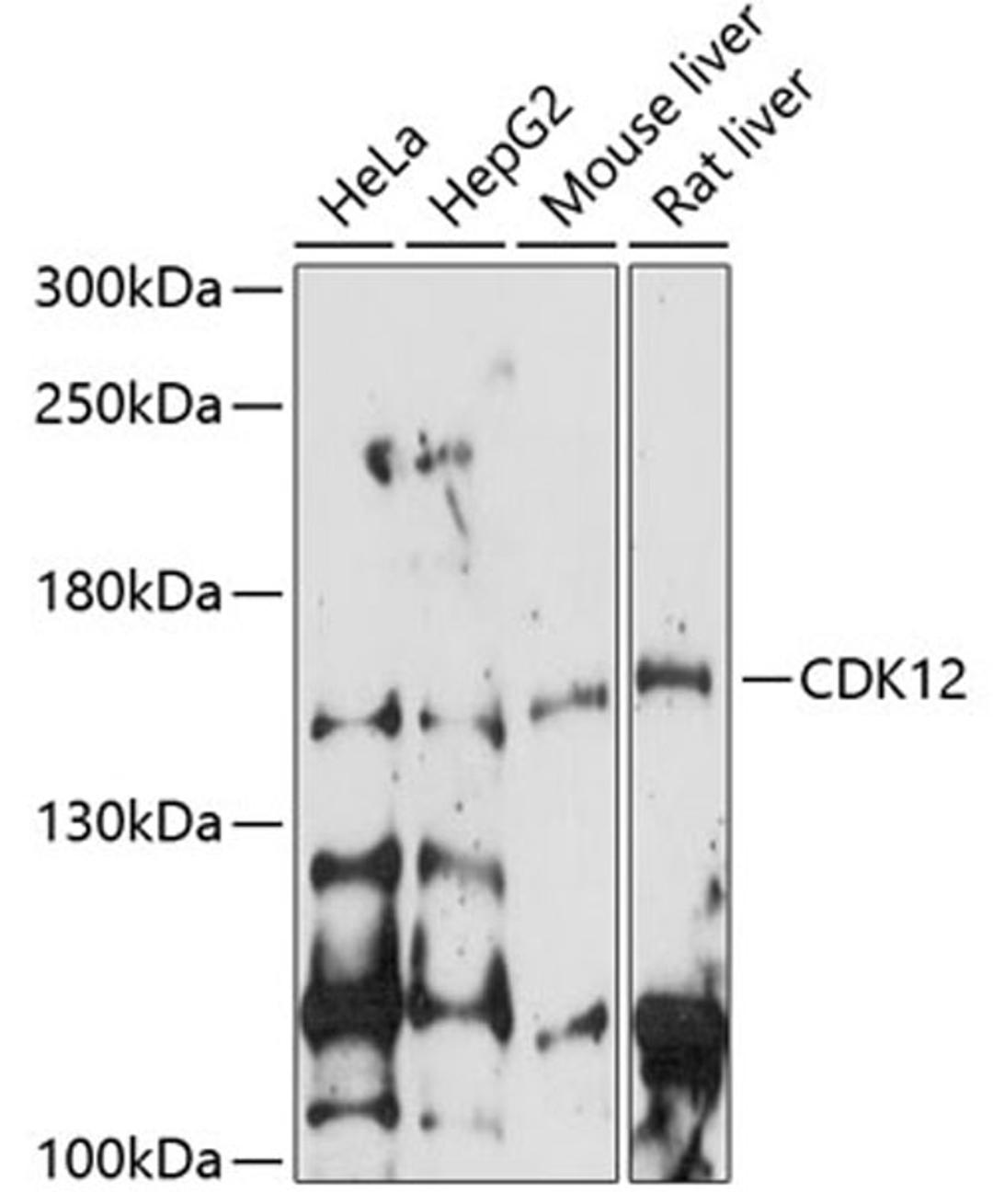 Western blot - CDK12 antibody (A14894)