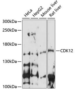 Western blot - CDK12 antibody (A14894)