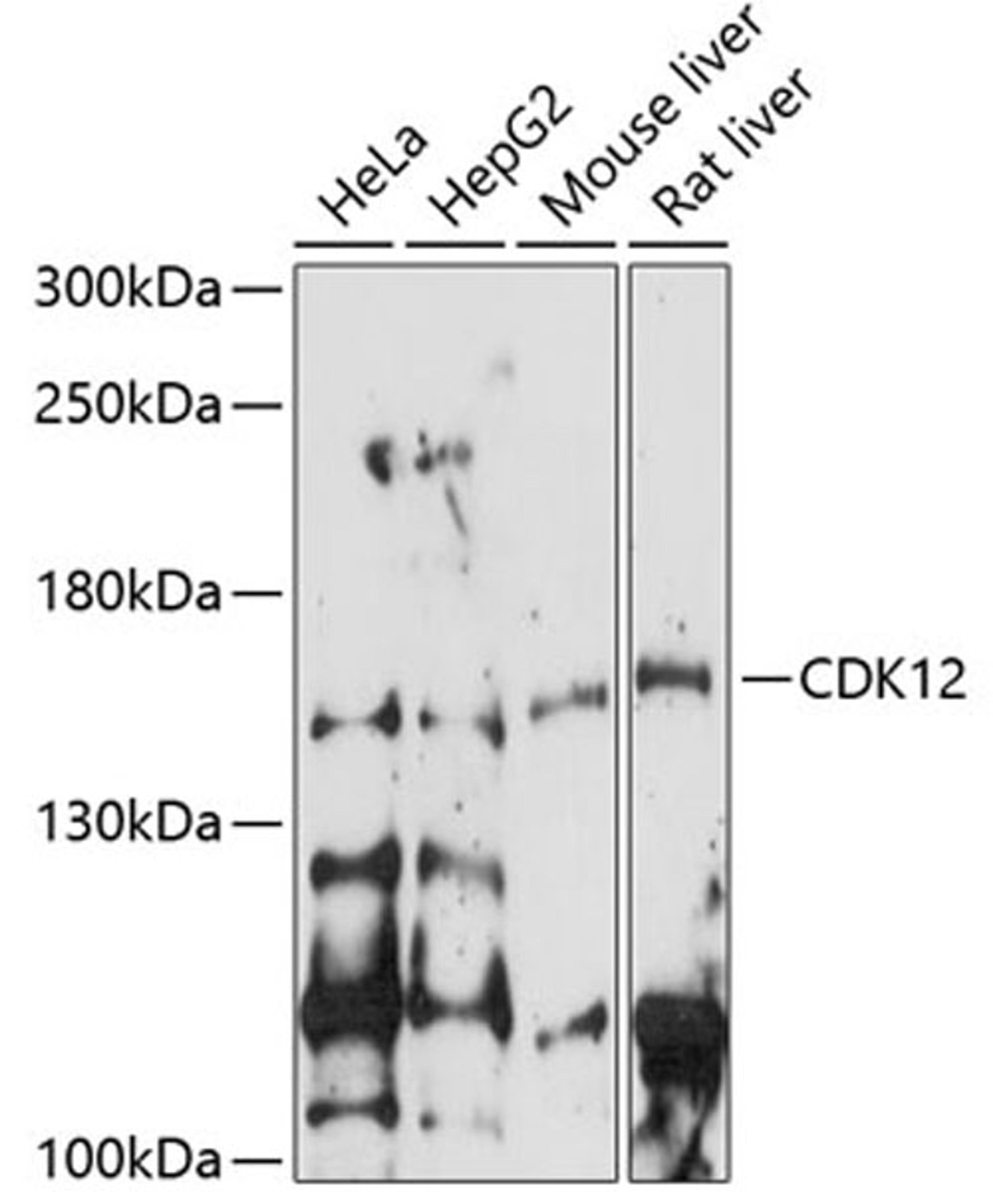 Western blot - CDK12 antibody (A14894)