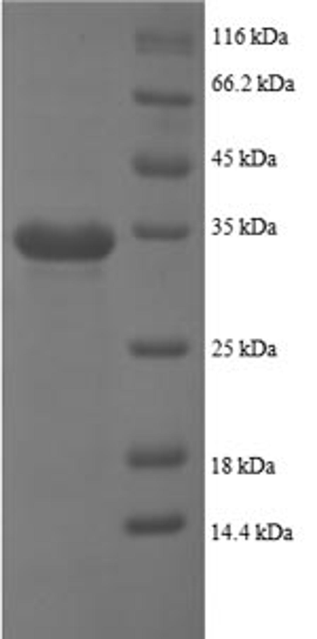 (Tris-Glycine gel) Discontinuous SDS-PAGE (reduced) with 5% enrichment gel and 15% separation gel.