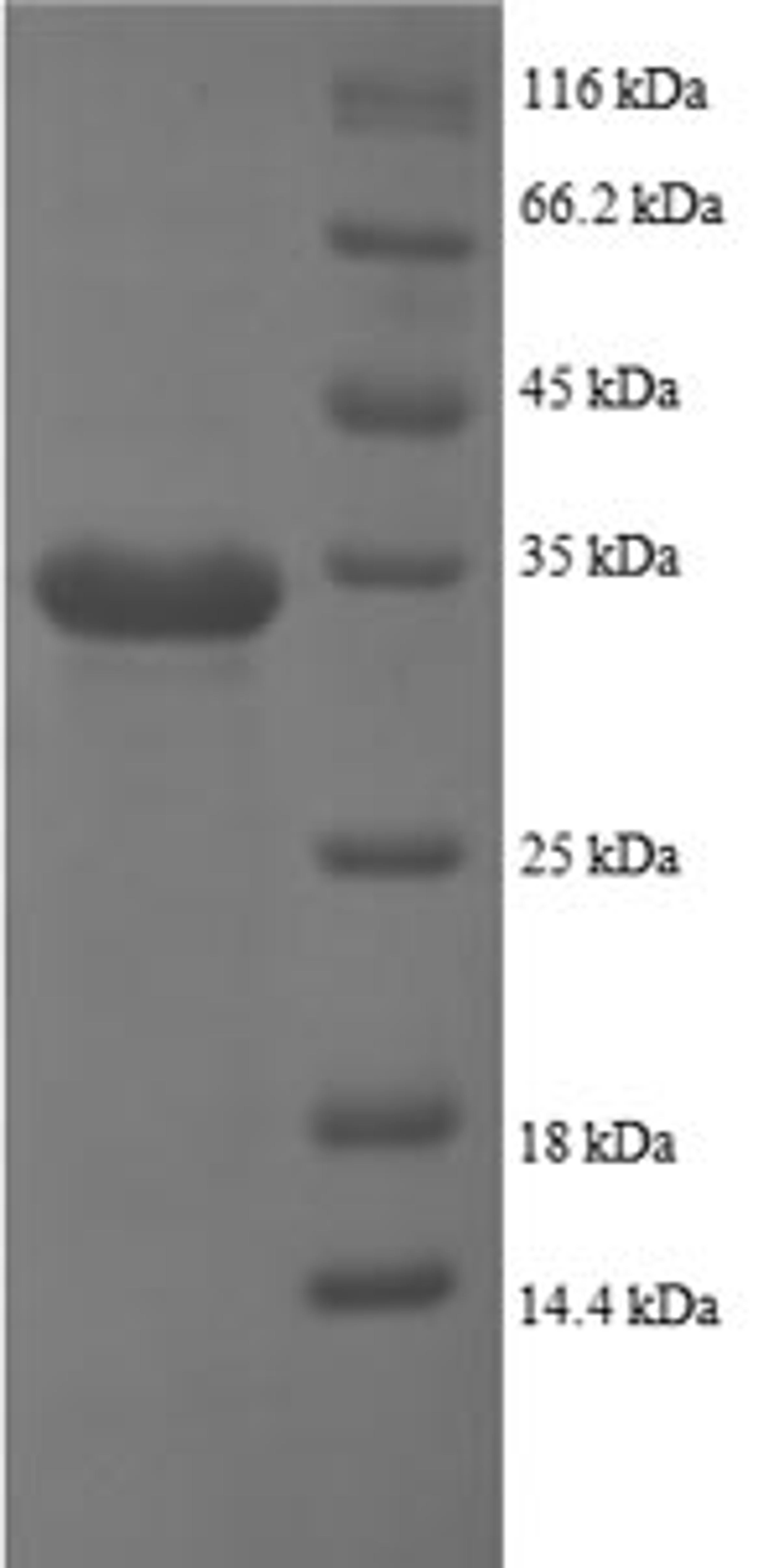 (Tris-Glycine gel) Discontinuous SDS-PAGE (reduced) with 5% enrichment gel and 15% separation gel.