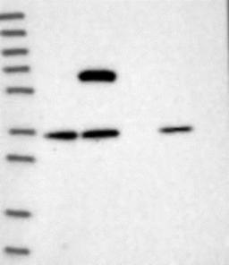 Western Blot: SNX25 Antibody [NBP1-80784] - Lane 1: Marker [kDa] 230, 130, 95, 72, 56, 36, 28, 17, 11<br/>Lane 2: RT-4<br/>Lane 3: U-251 MG<br/>Lane 4: Human Plasma<br/>Lane 5: Liver<br/>Lane 6: Tonsil