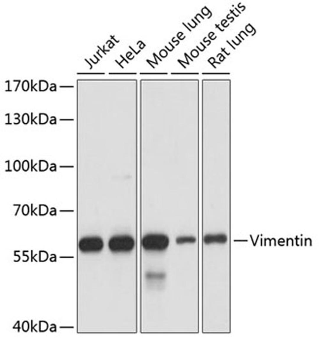 Western blot - Vimentin antibody (A11952)