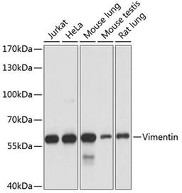 Western blot - Vimentin antibody (A11952)