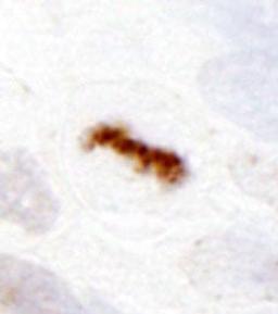 Detection of human Aurora B by immunohistochemistry.