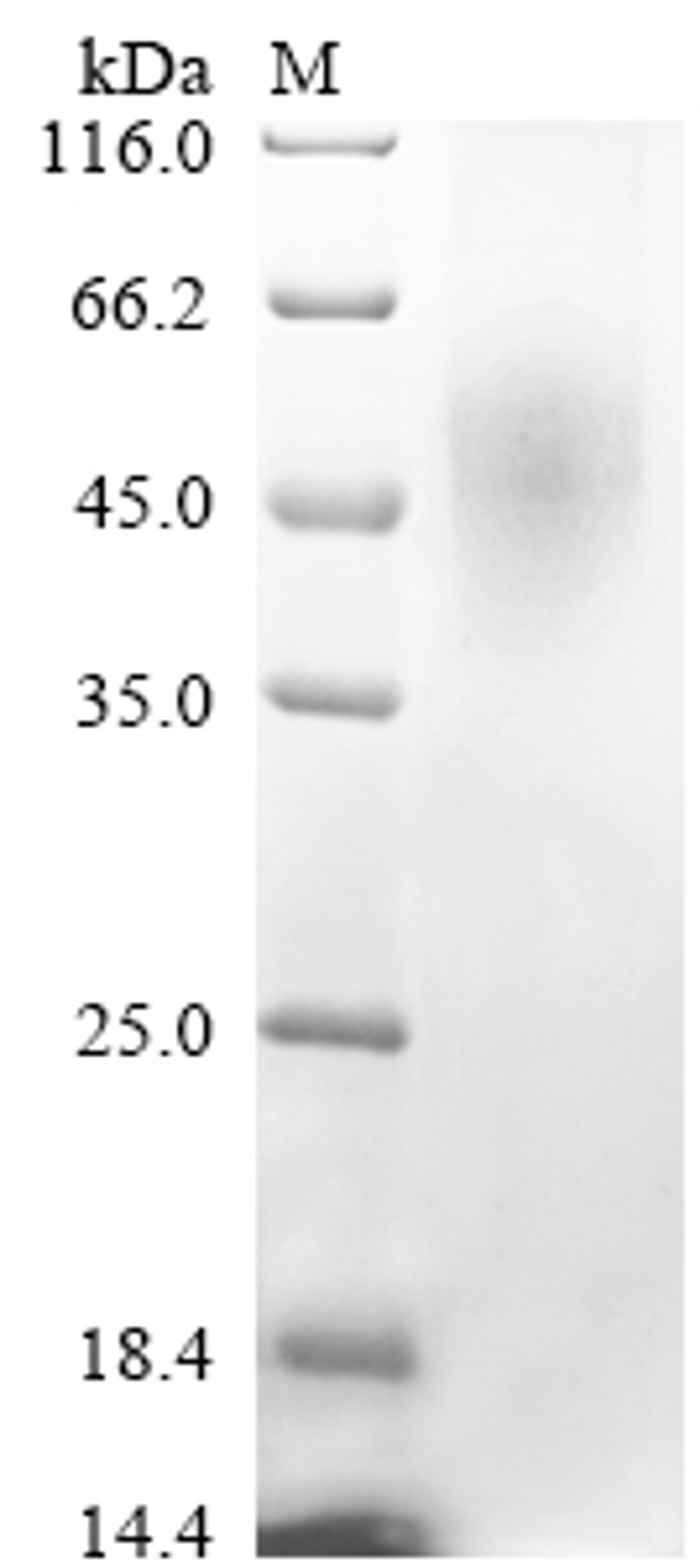 (Tris-Glycine gel) Discontinuous SDS-PAGE (reduced) with 5% enrichment gel and 15% separation gel.