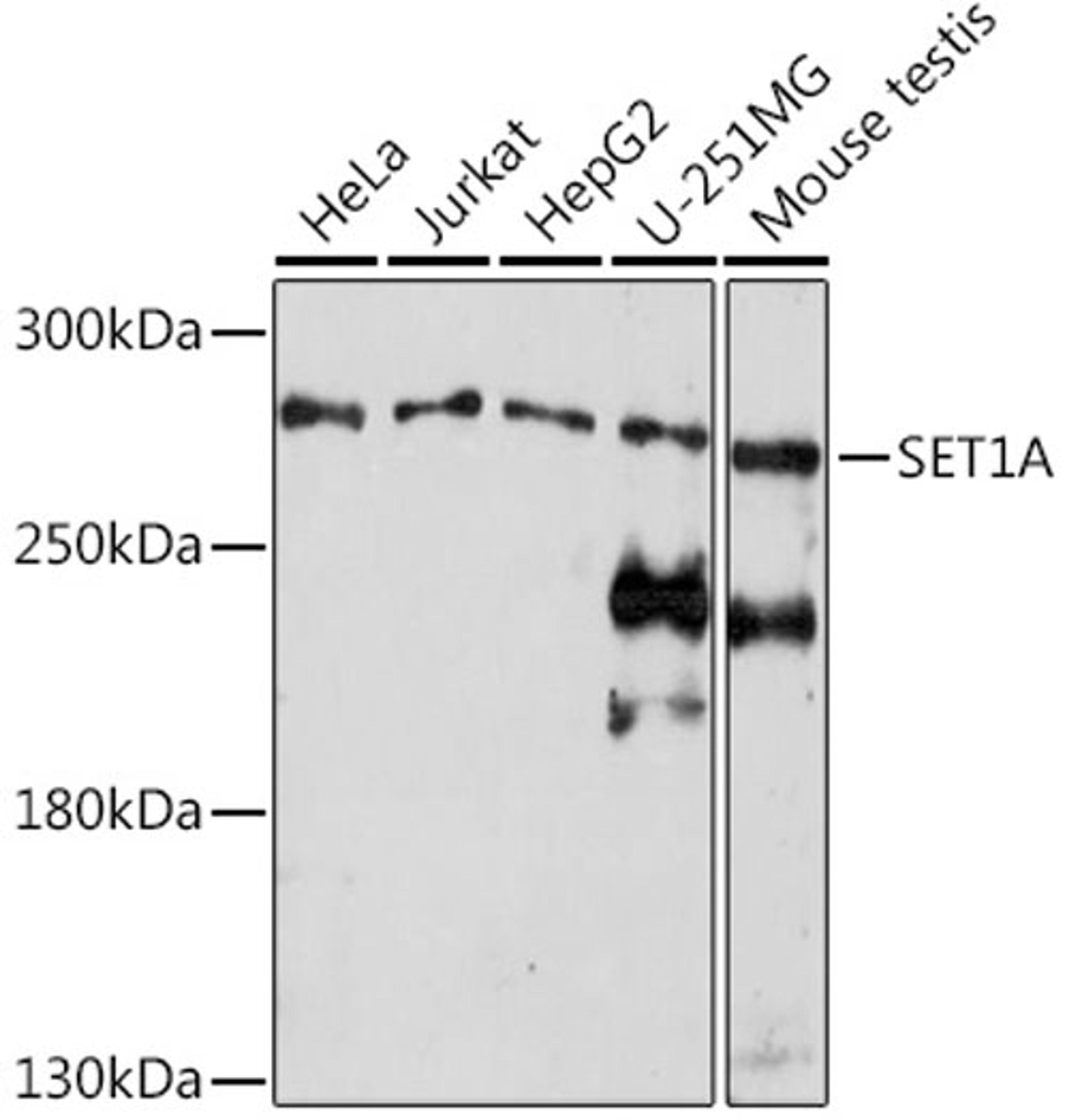 Western blot - SET1A Rabbit pAb (A18231)