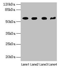 Western blot. All lanes: KRT79 antibody at 1µg/ml. Lane 1: Mouse lung tissue. Lane 2: A549 whole cell lysate. Lane 3: 293T whole cell lysate. Lane 4: Mouse gonadal tissue. Secondary. Goat polyclonal to rabbit IgG at 1/10000 dilution. Predicted band size: 58 kDa. Observed band size: 58 kDa