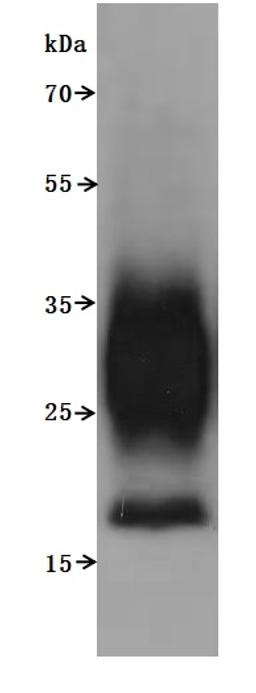 CSB-MP5031MOV is detected by Mouse anti-6*His monoclonal antibody.The two bands respectively correspond to monomer, Homodimer.