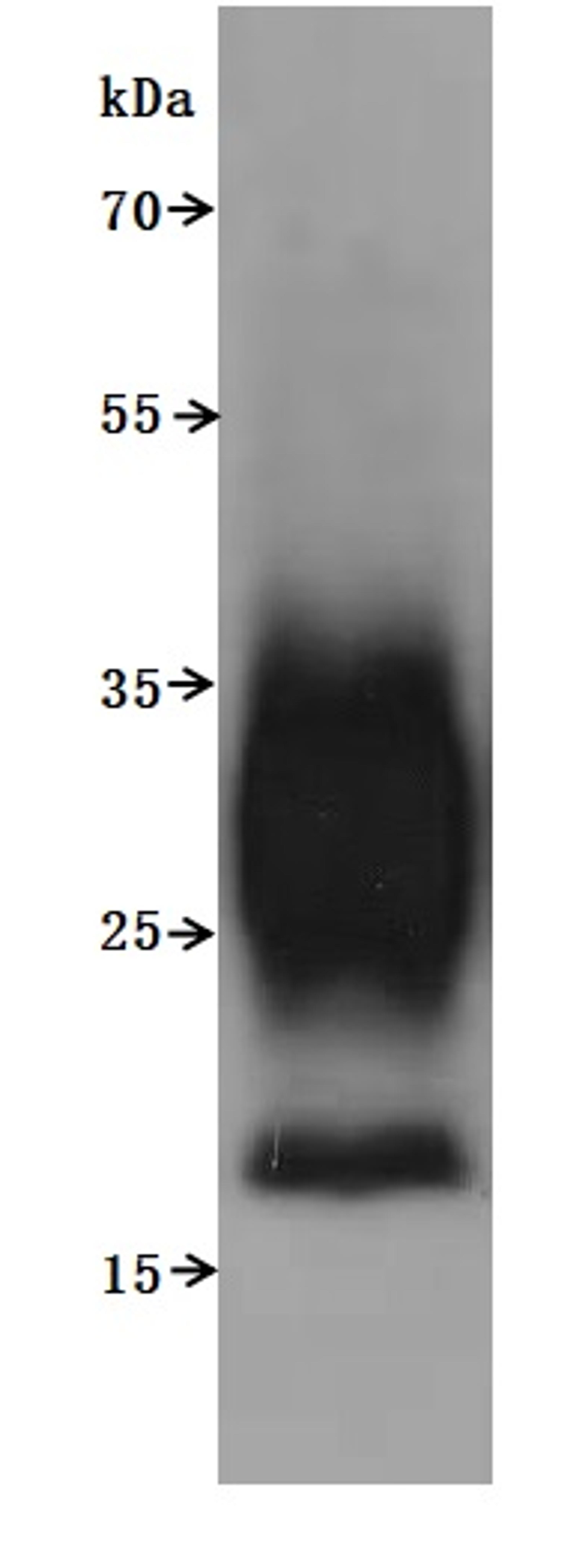 CSB-MP5031MOV is detected by Mouse anti-6*His monoclonal antibody.The two bands respectively correspond to monomer, Homodimer.