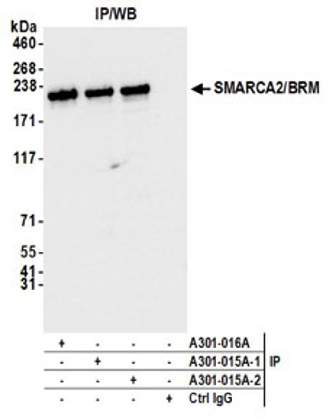 Detection of human SMARCA2/BRM by western blot of immunoprecipitates.