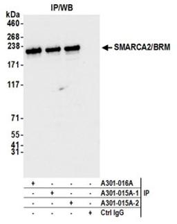 Detection of human SMARCA2/BRM by western blot of immunoprecipitates.