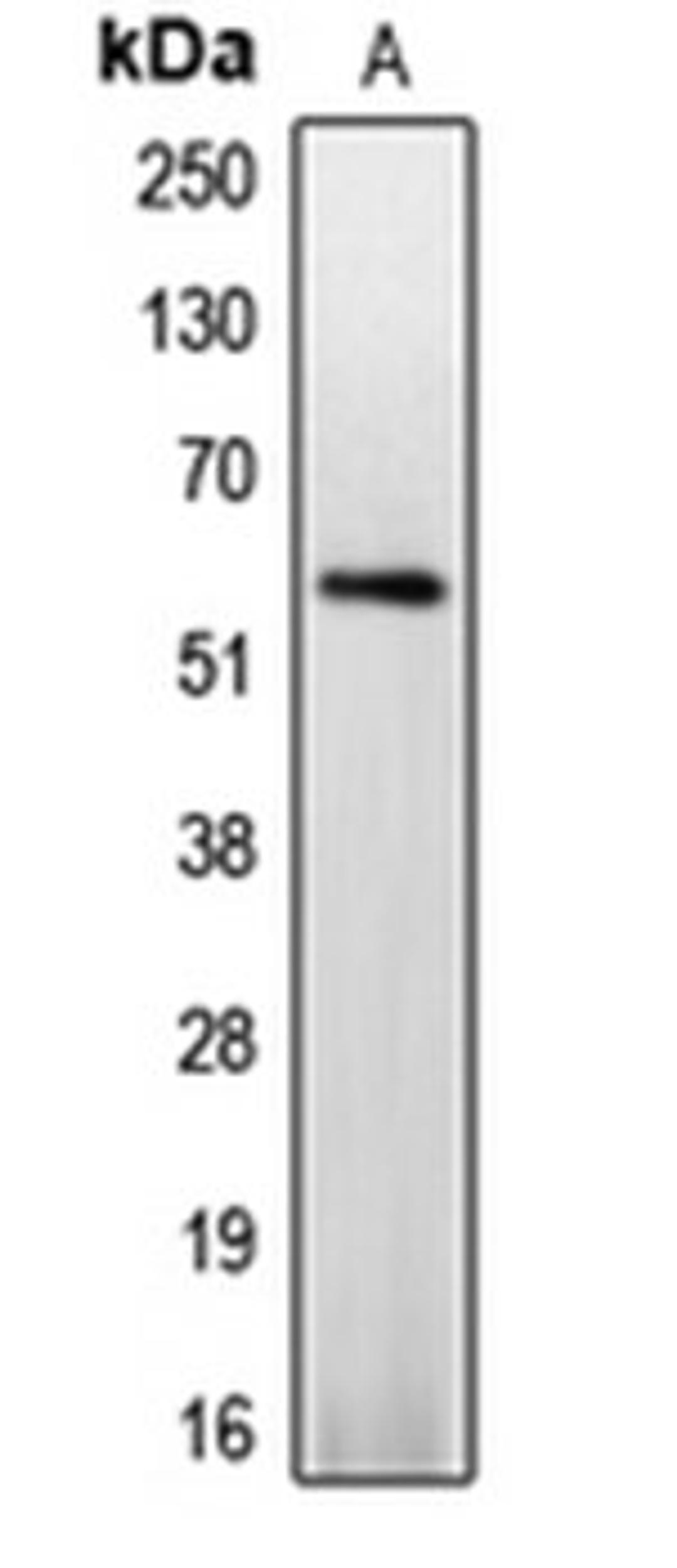 Western blot analysis of Jurkat PMA-treated (Lane 1) whole cell lysates using CASP8 antibody