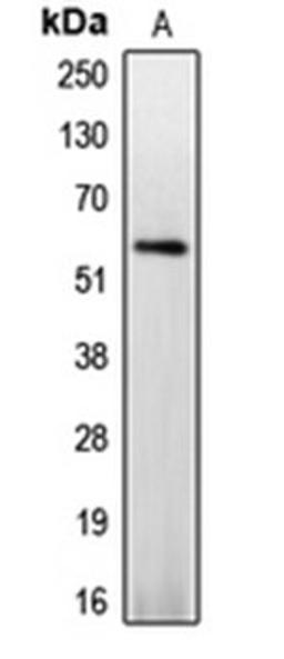 Western blot analysis of Jurkat PMA-treated (Lane 1) whole cell lysates using CASP8 antibody