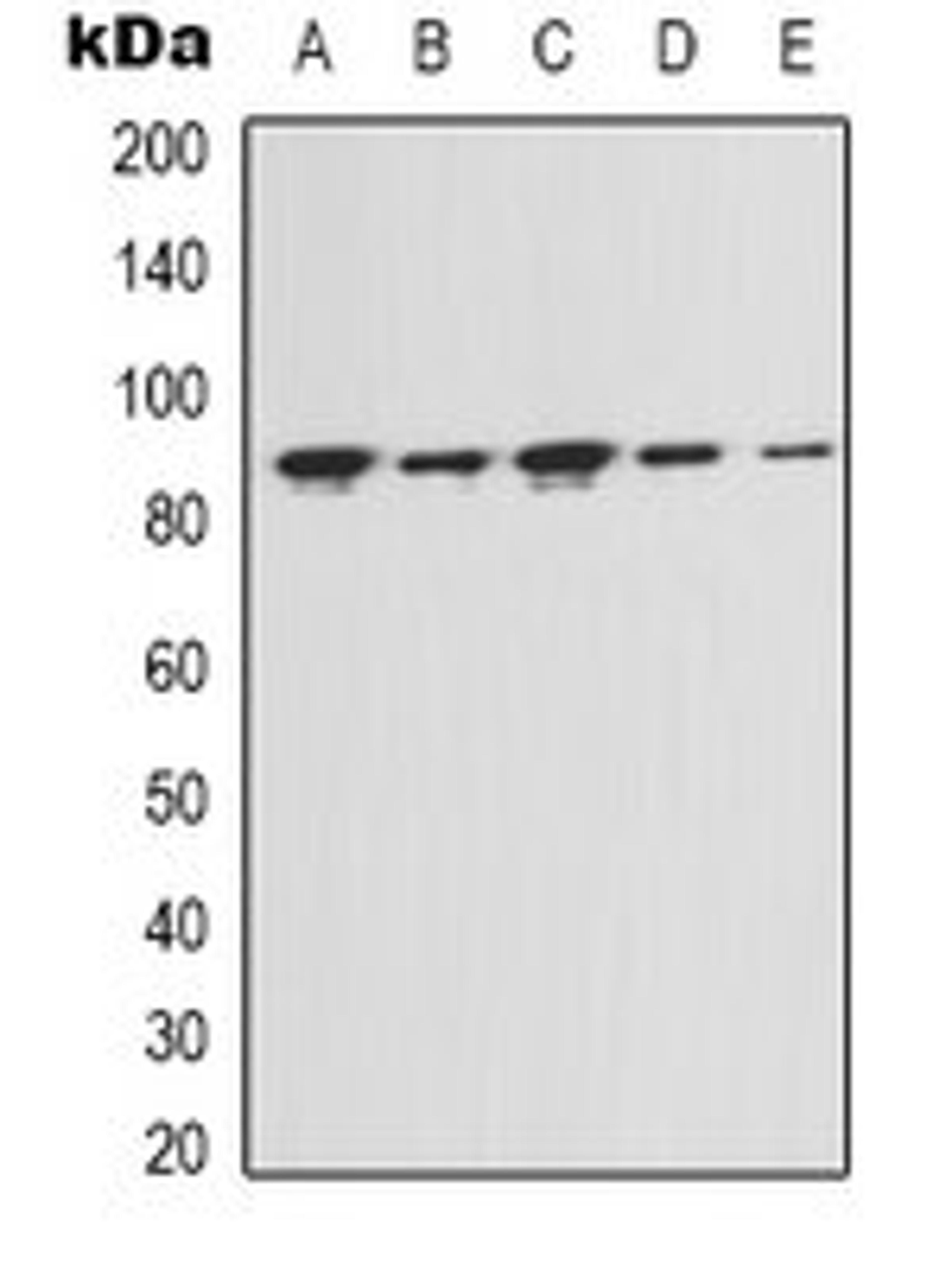 Western blot analysis of Hela (Lane 1), MCF7 (Lane 2), NIH3T3 (Lane 3), mouse kidney (Lane 4), rat liver (Lane 5) whole cell lysates using FAP alpha antibody