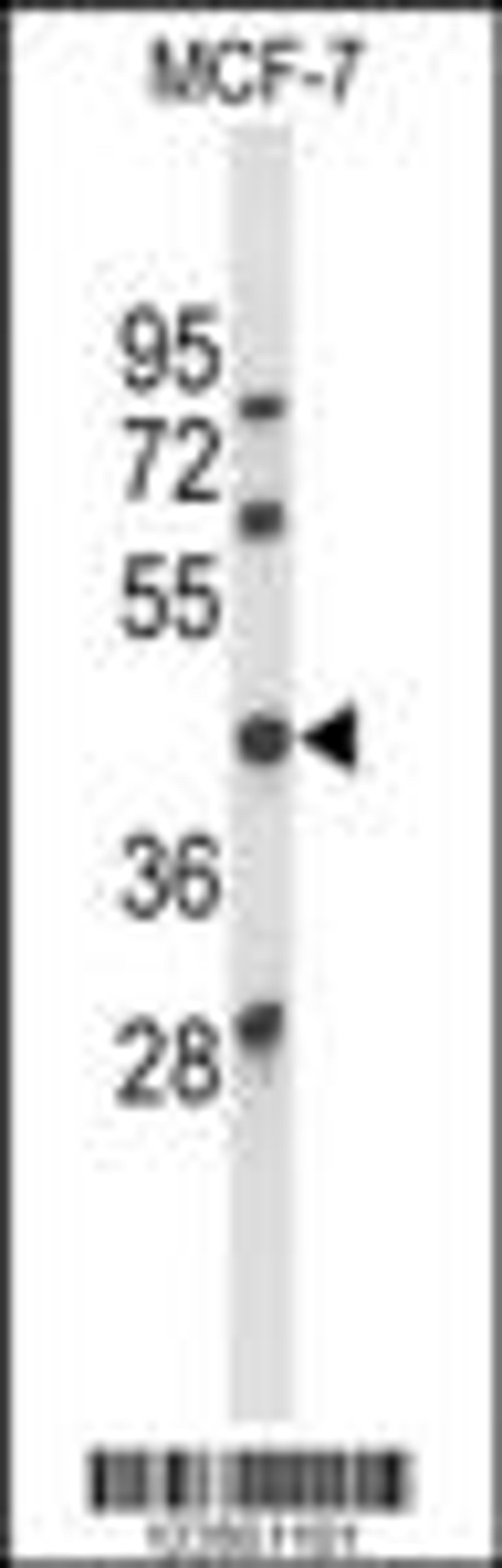 Western blot analysis of ATXN3 Antibody in MCF-7 cell line lysates (35ug/lane)