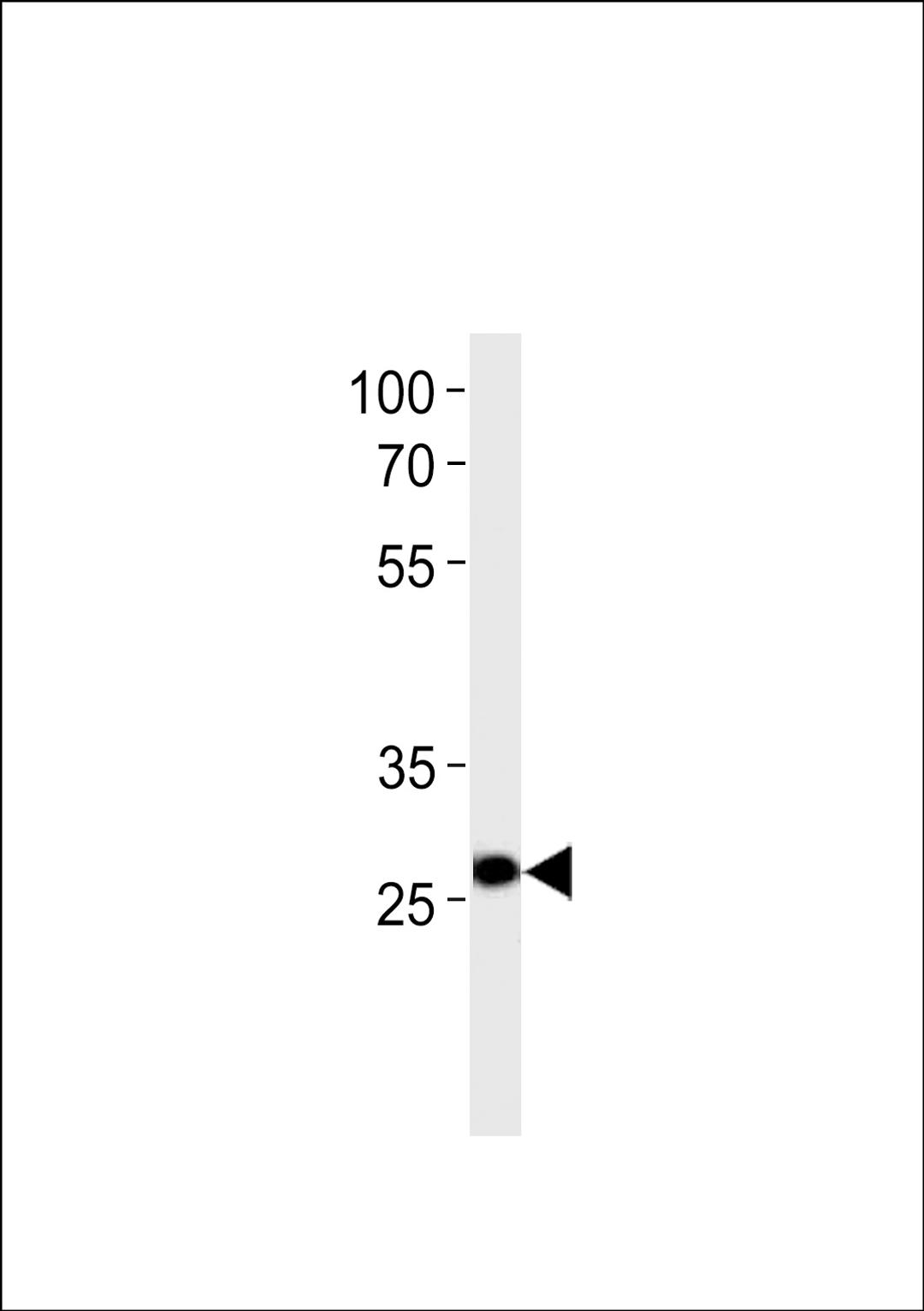 Western blot analysis in U-937 cell line lysates (35ug/lane).