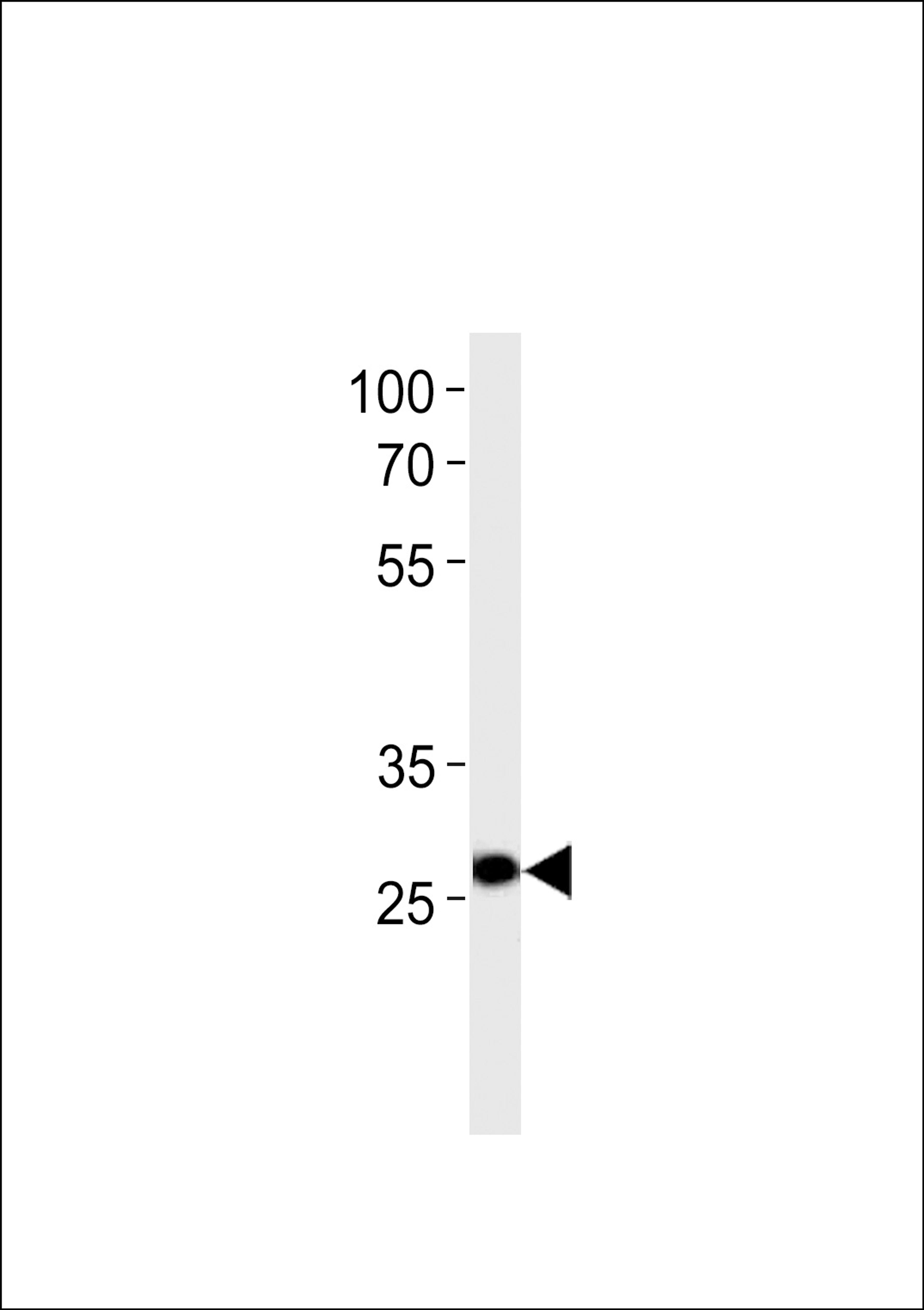 Western blot analysis in U-937 cell line lysates (35ug/lane).