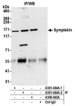 Detection of human Symplekin by western blot of immunoprecipitates.