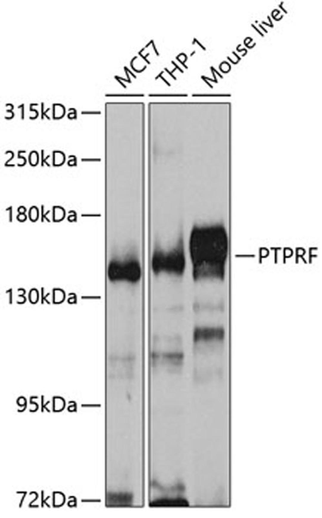 Western blot - PTPRF antibody (A5444)