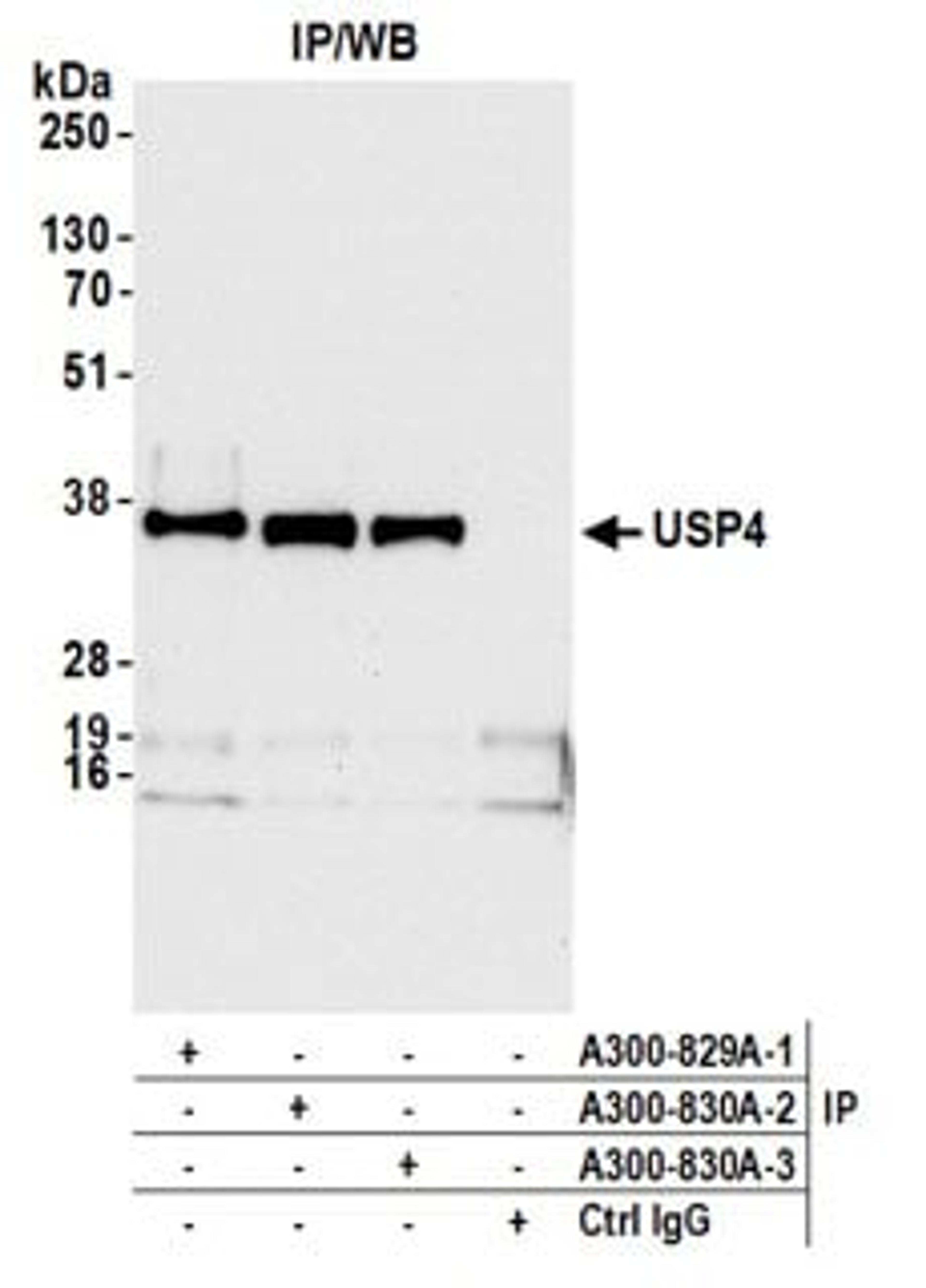 Detection of human USP4 by western blot of immunoprecipitates.