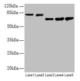 Western blot. All lanes: APP antibody at 2.4µg/ml. Lane 1: Mouse brain tissue. Lane 2: 293 whole cell lysate. Lane 3: A549 whole cell lysate. Lane 4: U251 whole cell lysate. Lane 5: SH-SY5Y whole cell lysate. Secondary. Goat polyclonal to rabbit IgG at 1/15000 dilution. Predicted band size: 87, 35, 77, 79, 81, 83, 85, 86, 73 kDa. Observed band size: 81, 73 kDa