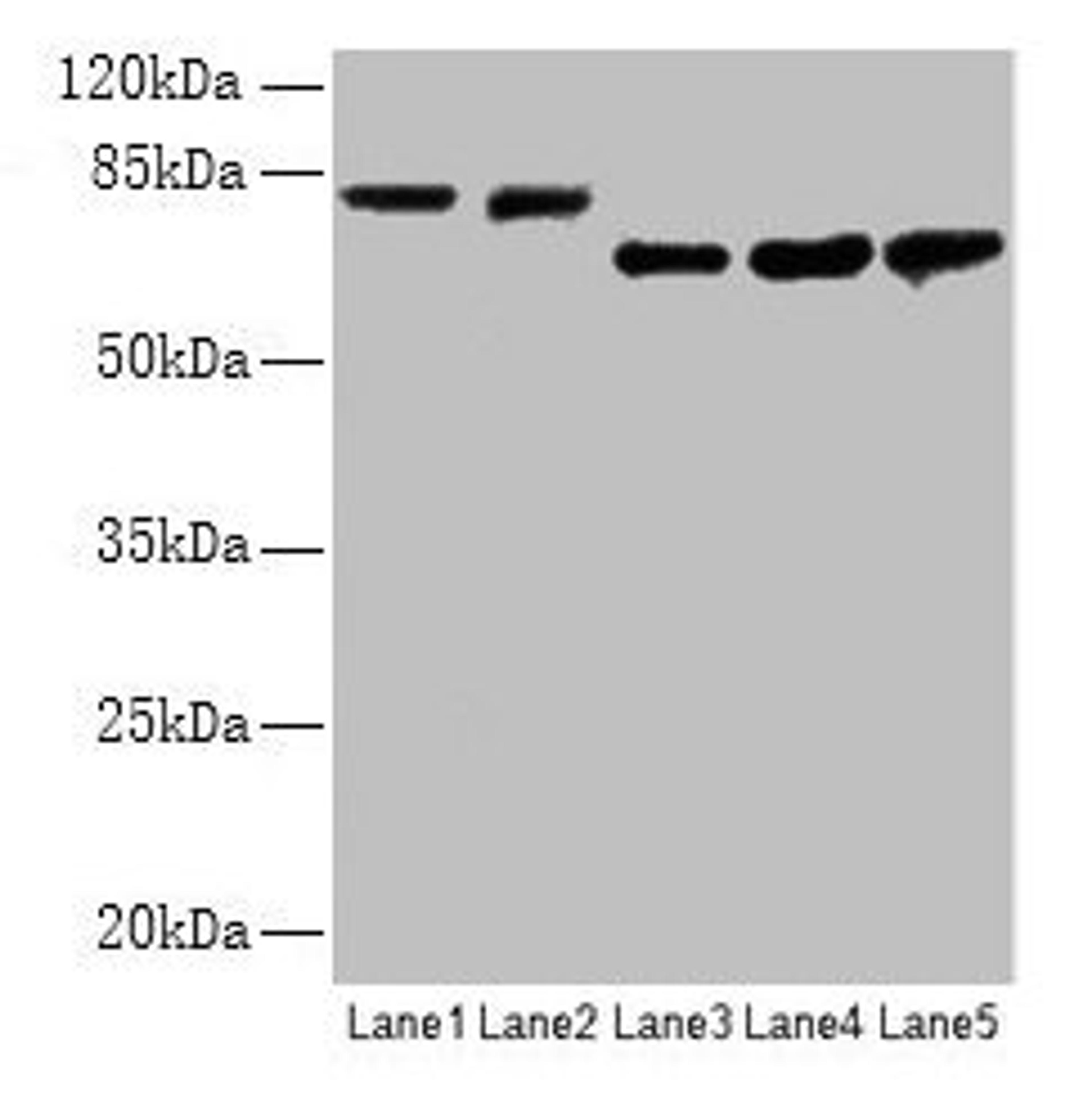 Western blot. All lanes: APP antibody at 2.4µg/ml. Lane 1: Mouse brain tissue. Lane 2: 293 whole cell lysate. Lane 3: A549 whole cell lysate. Lane 4: U251 whole cell lysate. Lane 5: SH-SY5Y whole cell lysate. Secondary. Goat polyclonal to rabbit IgG at 1/15000 dilution. Predicted band size: 87, 35, 77, 79, 81, 83, 85, 86, 73 kDa. Observed band size: 81, 73 kDa