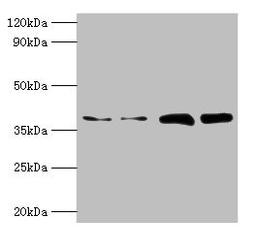 Western blot. All lanes: TBCC antibody at 2µg/ml. Lane 1: Hela whole cell lysate. Lane 2: HepG2 whole cell lysate. Lane 3: A549 whole cell lysate. Lane 4: MCF-7 whole cell lysate. Secondary. Goat polyclonal to rabbit IgG at 1/10000 dilution. Predicted band size: 40 kDa. Observed band size: 40 kDa
