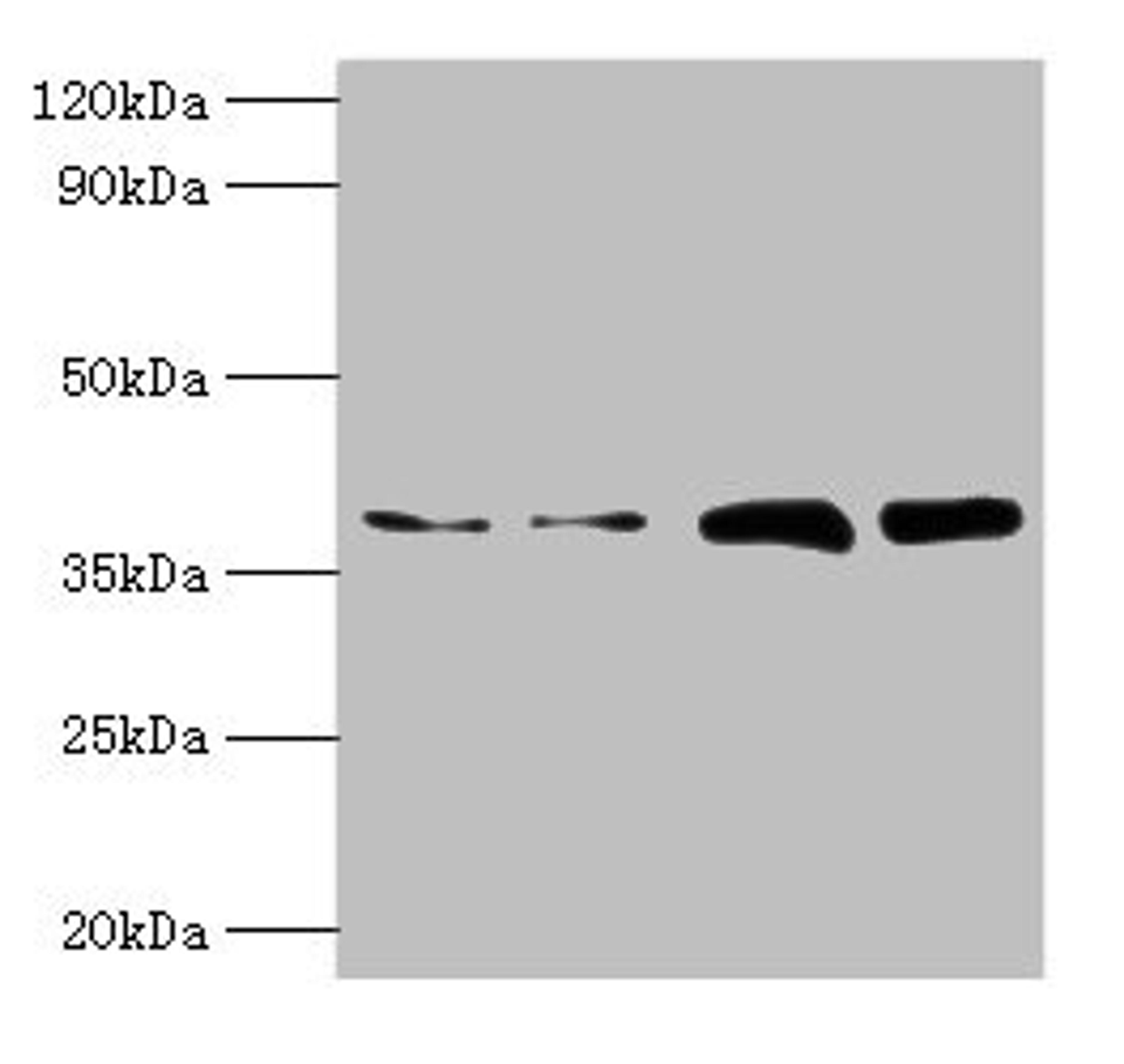 Western blot. All lanes: TBCC antibody at 2µg/ml. Lane 1: Hela whole cell lysate. Lane 2: HepG2 whole cell lysate. Lane 3: A549 whole cell lysate. Lane 4: MCF-7 whole cell lysate. Secondary. Goat polyclonal to rabbit IgG at 1/10000 dilution. Predicted band size: 40 kDa. Observed band size: 40 kDa