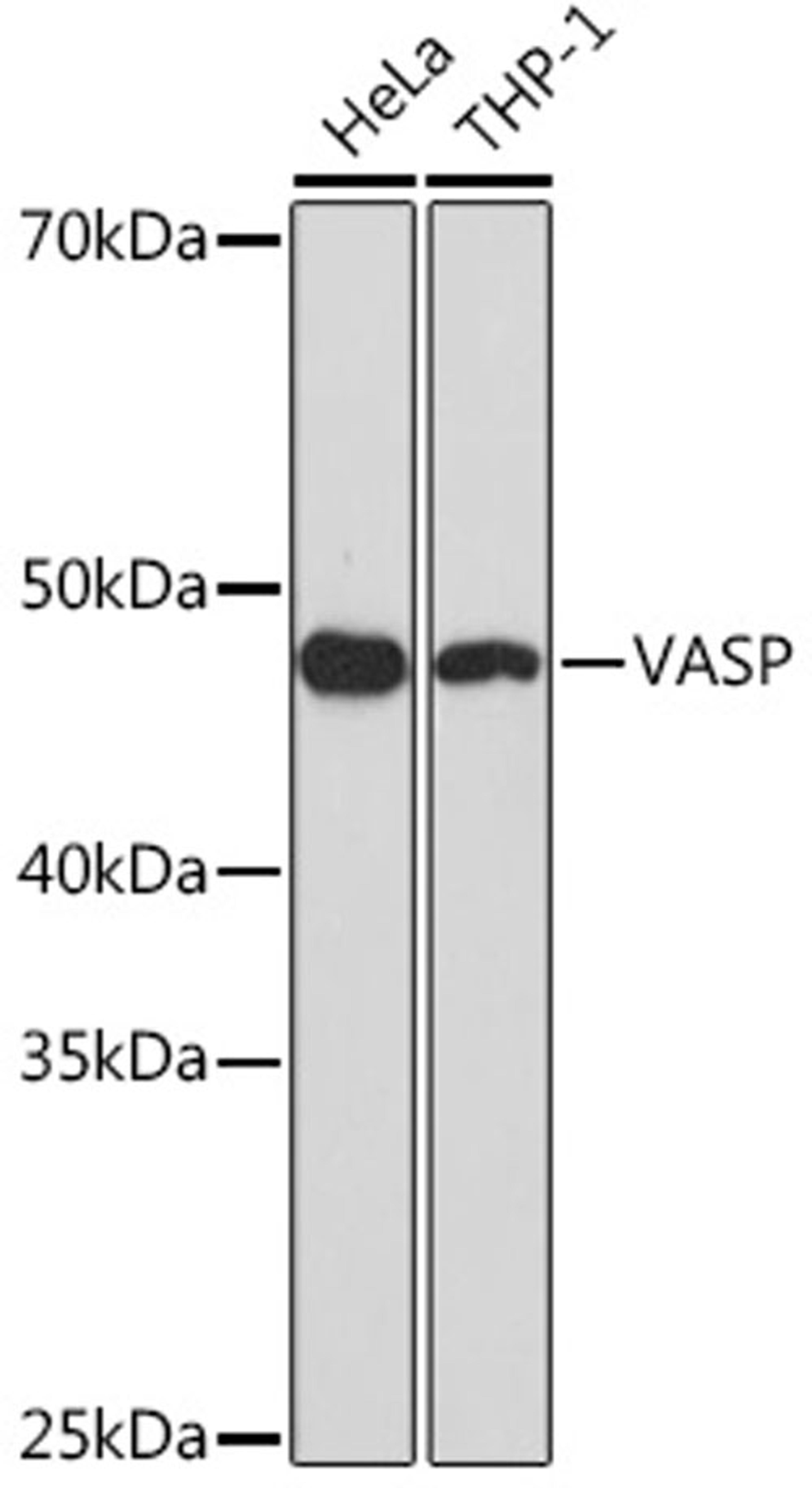 Western blot - VASP Rabbit mAb (A8862)