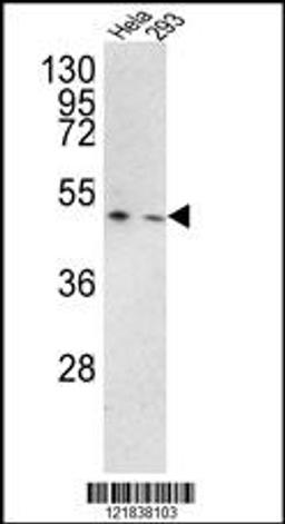 Western blot analysis of TMPRSS3 Antibody in Hela, 293 cell line lysates (35ug/lane)