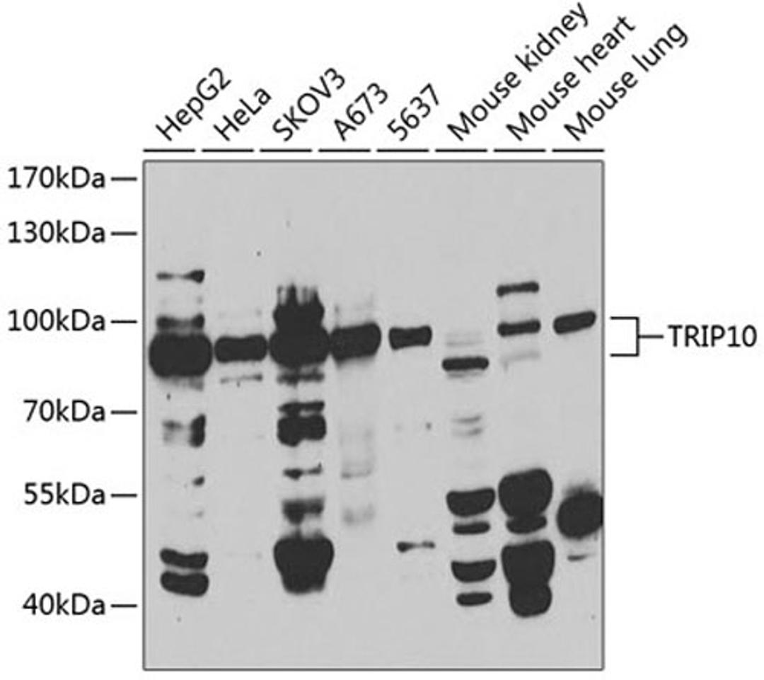 Western blot - TRIP10 antibody (A7038)